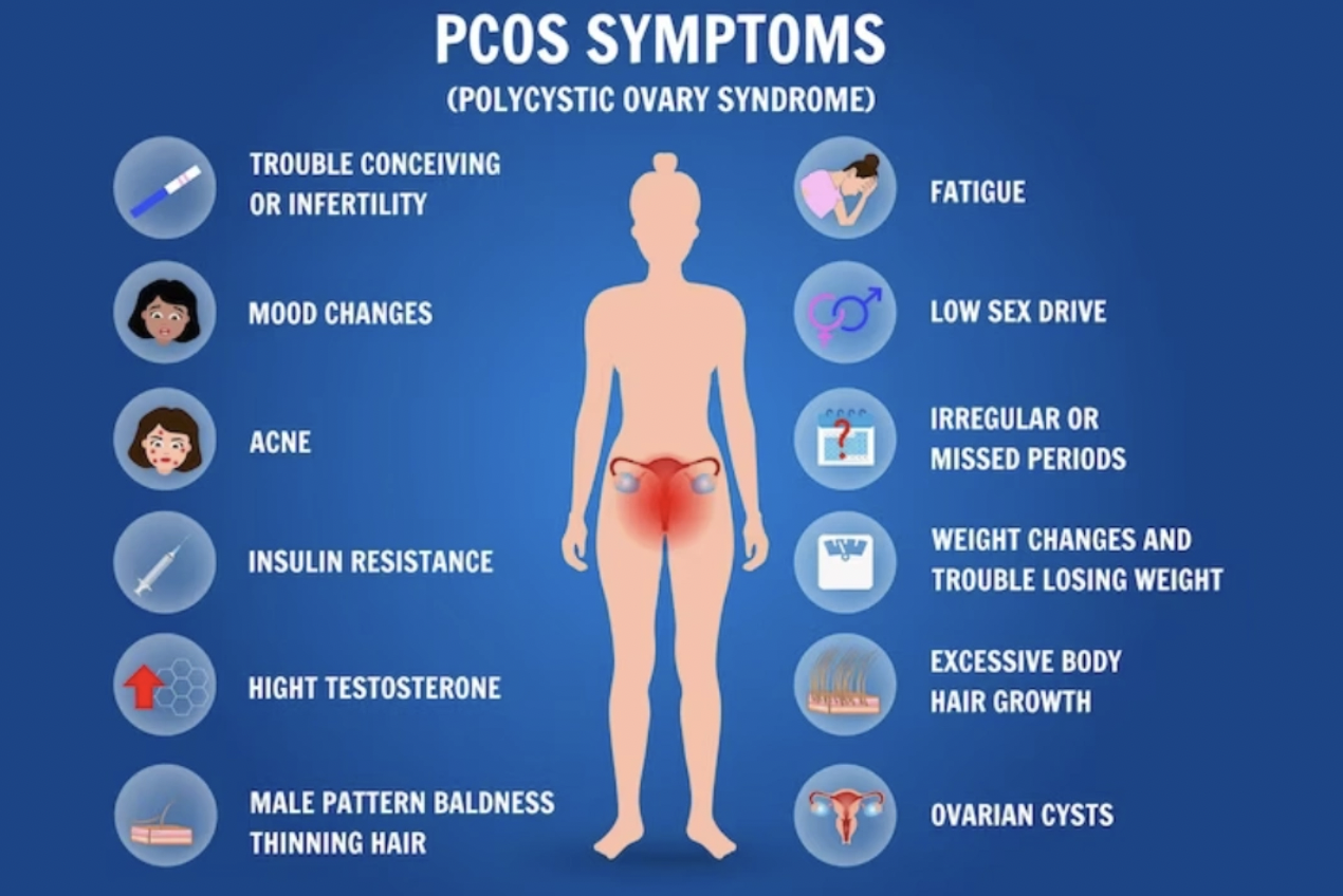 Functional Medicine Approach to PCOS